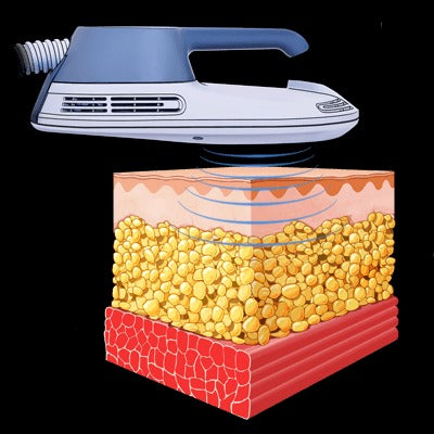 New York Emsculpt Body Contouring