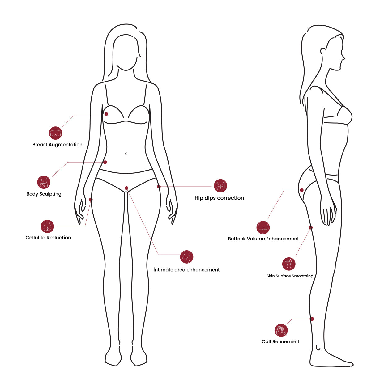 REMEDIUM 100 HA BODY FILLER 100CC (24MG/CC)