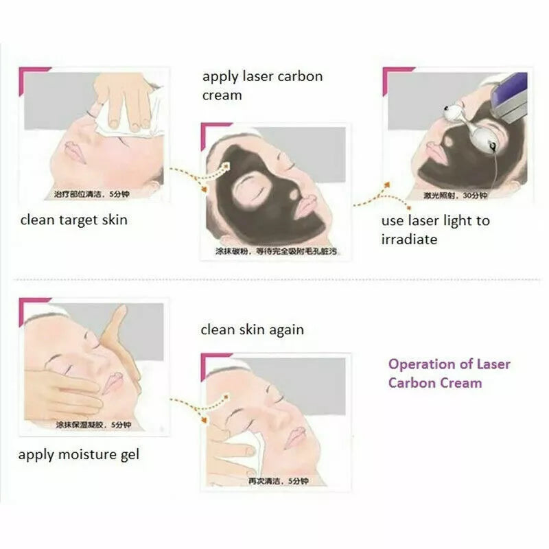 Black Carbon Gel for Pico Laser – Deep Cleansing & Moisturizing